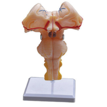 Brain stem enlargement model